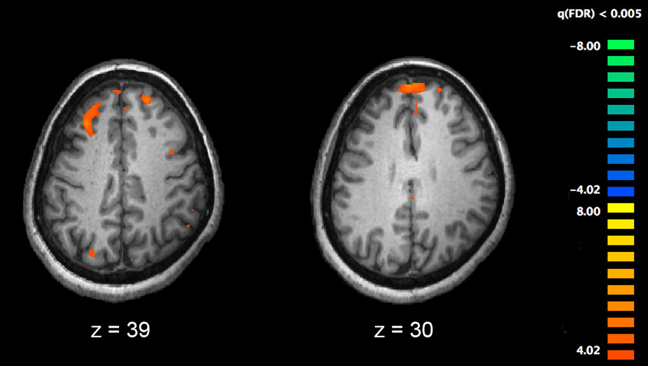 Cervello: ripensare, per capire