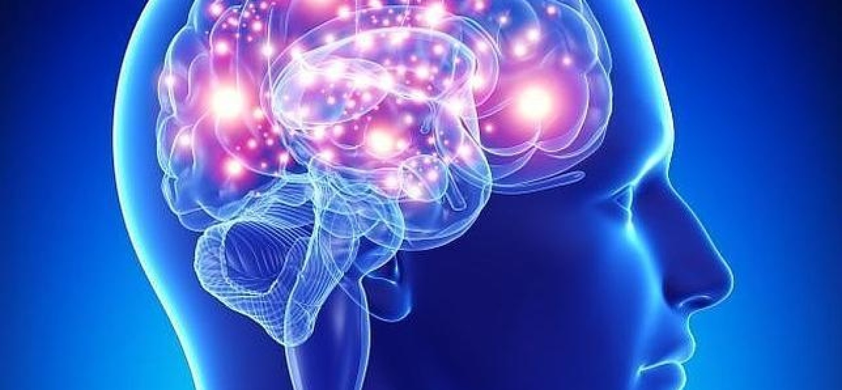 Per il trattamento di alta pressione per la prima volta utilizzata la stimolazione cerebrale profonda