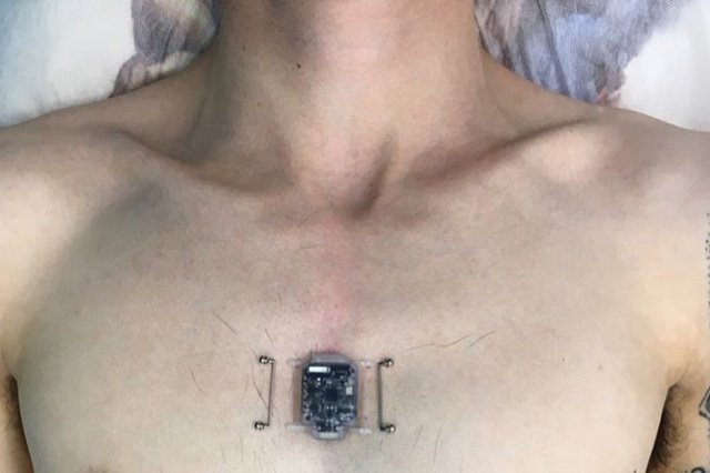Novosibirsk programmer has installed compass-implant