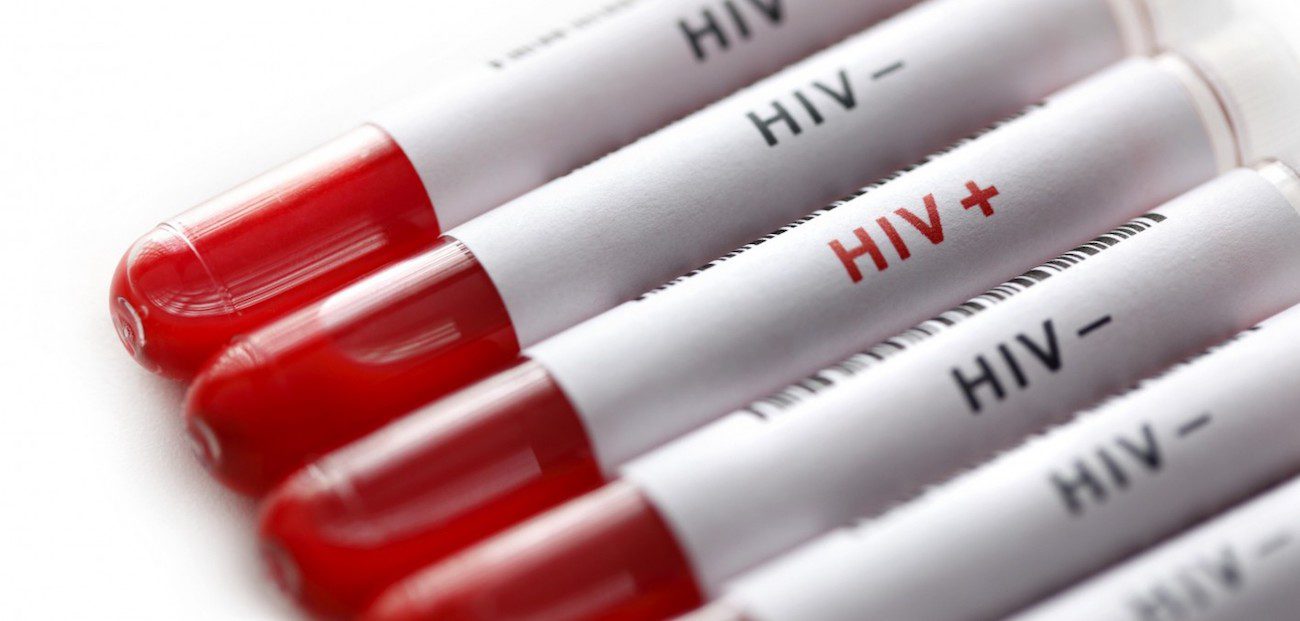 È stato sviluppato un test che permette di identificare la «sospensione» del HIV