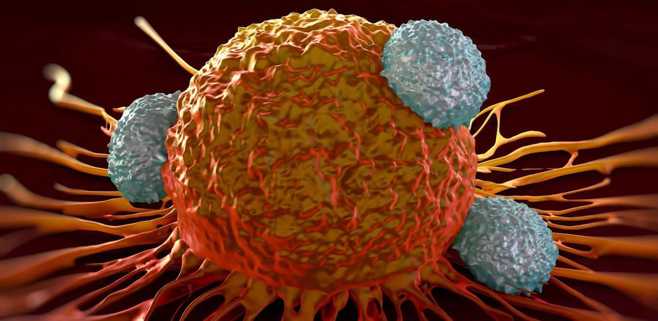 Con l'aiuto di immunoterapia è riuscito a sconfiggere il tipo aggressivo di cancro al seno