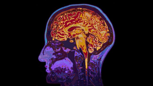 Comment justifier le battage médiatique sur le thème de l'amélioration du cerveau?