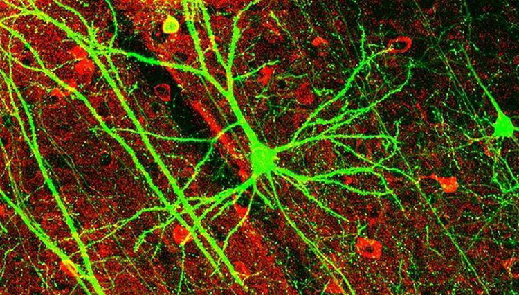 A visão clássica sobre o trabalho de neurônios do cérebro errada