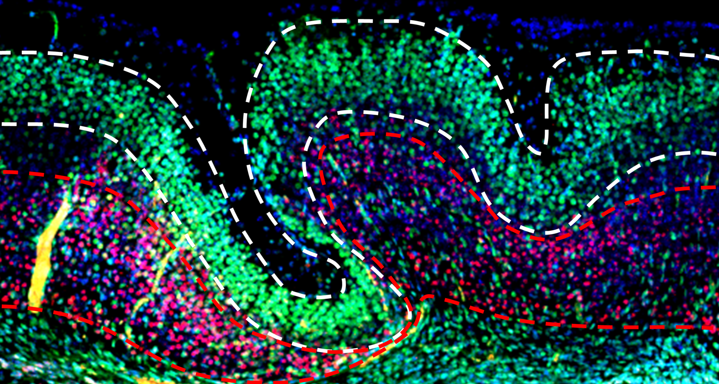 Neurowissenschaftler geben uns die ewige Seligkeit. Aber ob es gut ist?