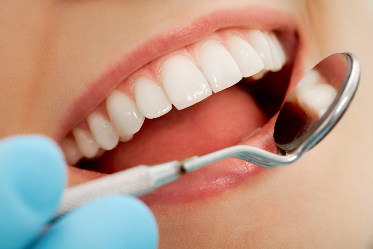 कनाडा के वैज्ञानिकों ने बनाया है लगभग सदा दंत fillings