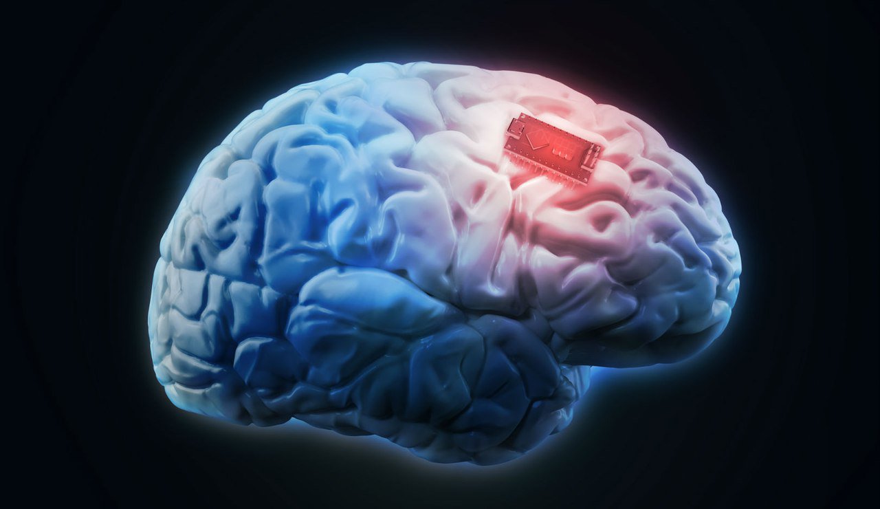 Implants to improve memory you can use. And they work!