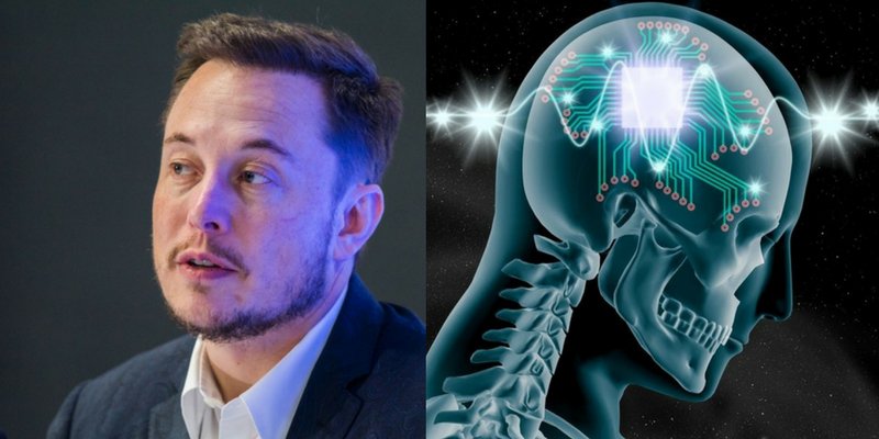 Neuralink Elon musk 은 건물을 위한 실험실 동물 테스트