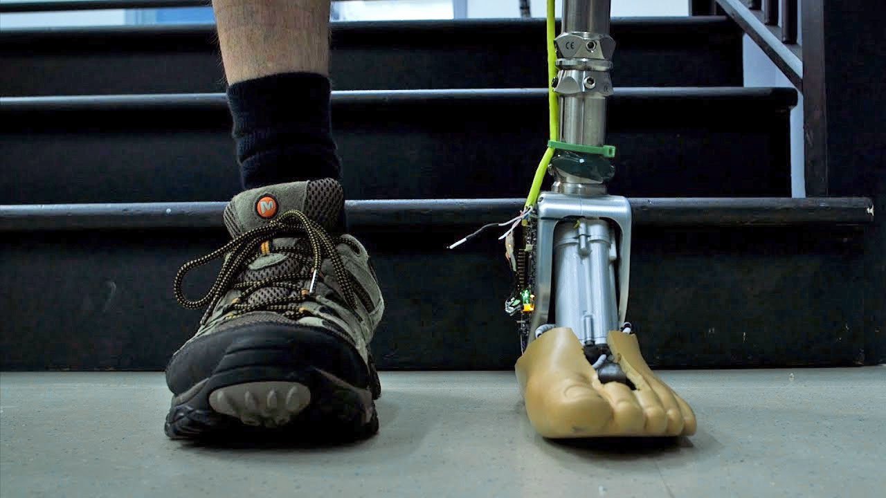 Geliştirilen yapay ayak bileği, адаптирующаяся bu düzensiz yüzeyler