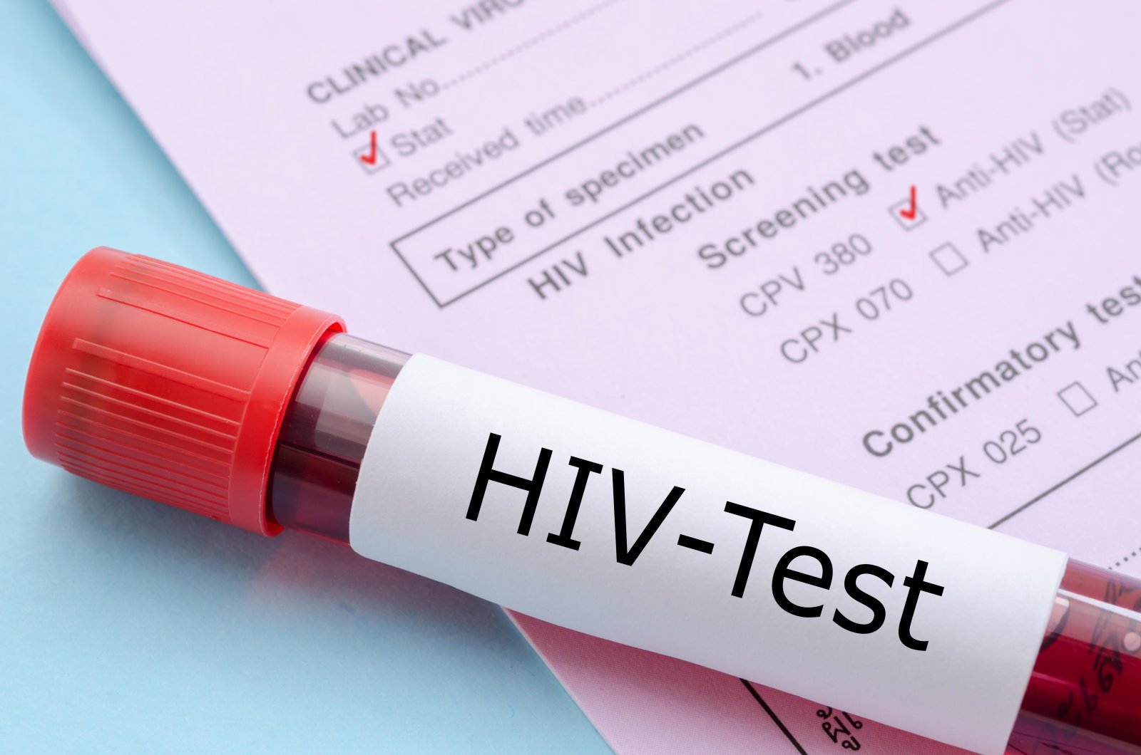 नई एचआईवी वैक्सीन अच्छा परिणाम दिखाया गया है मानव परीक्षणों में