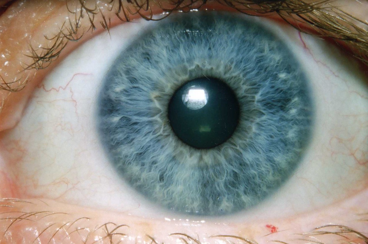 Google har lavet en AI til diagnosticering af øjensygdomme