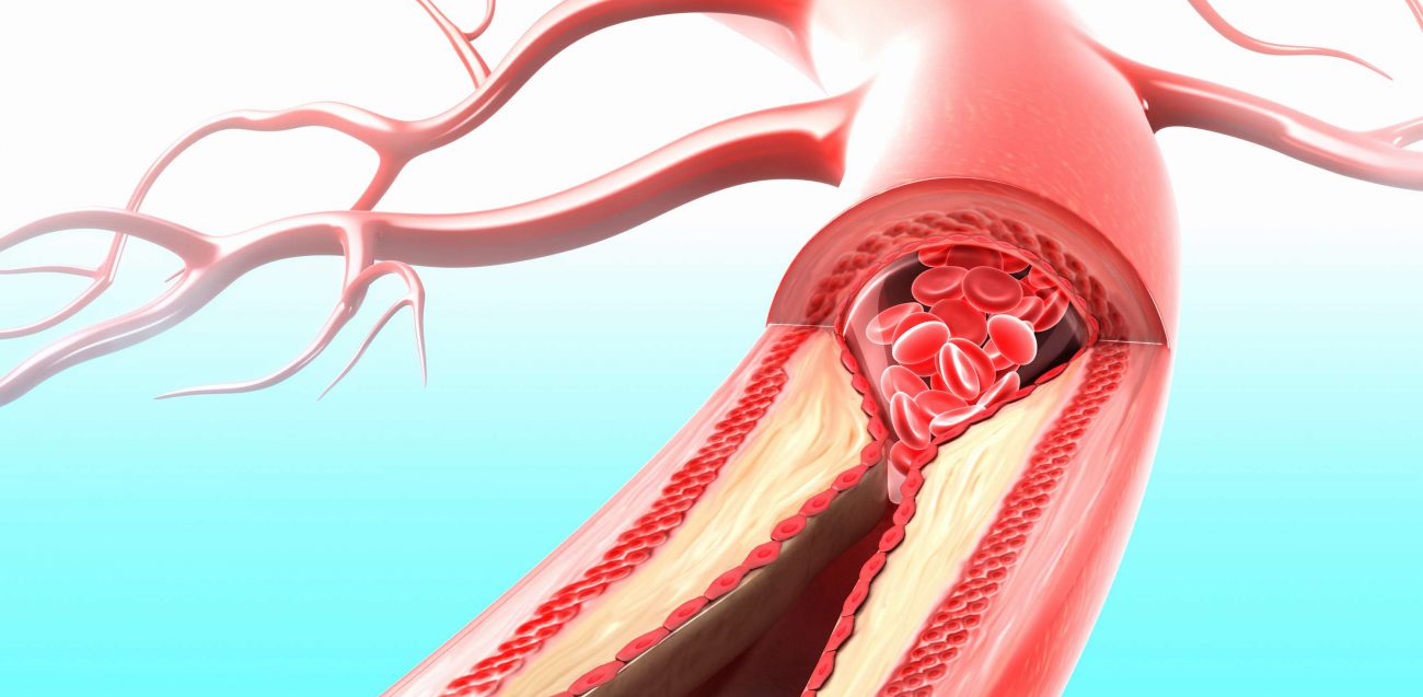 L'applicazione vi dirà circa le malattie del cuore e dei vasi sanguigni senza tagli e punture