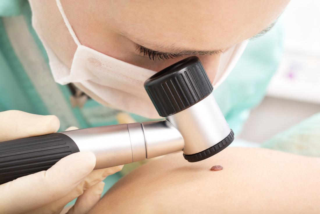 The melanoma vaccine has provided 100% survival during the test