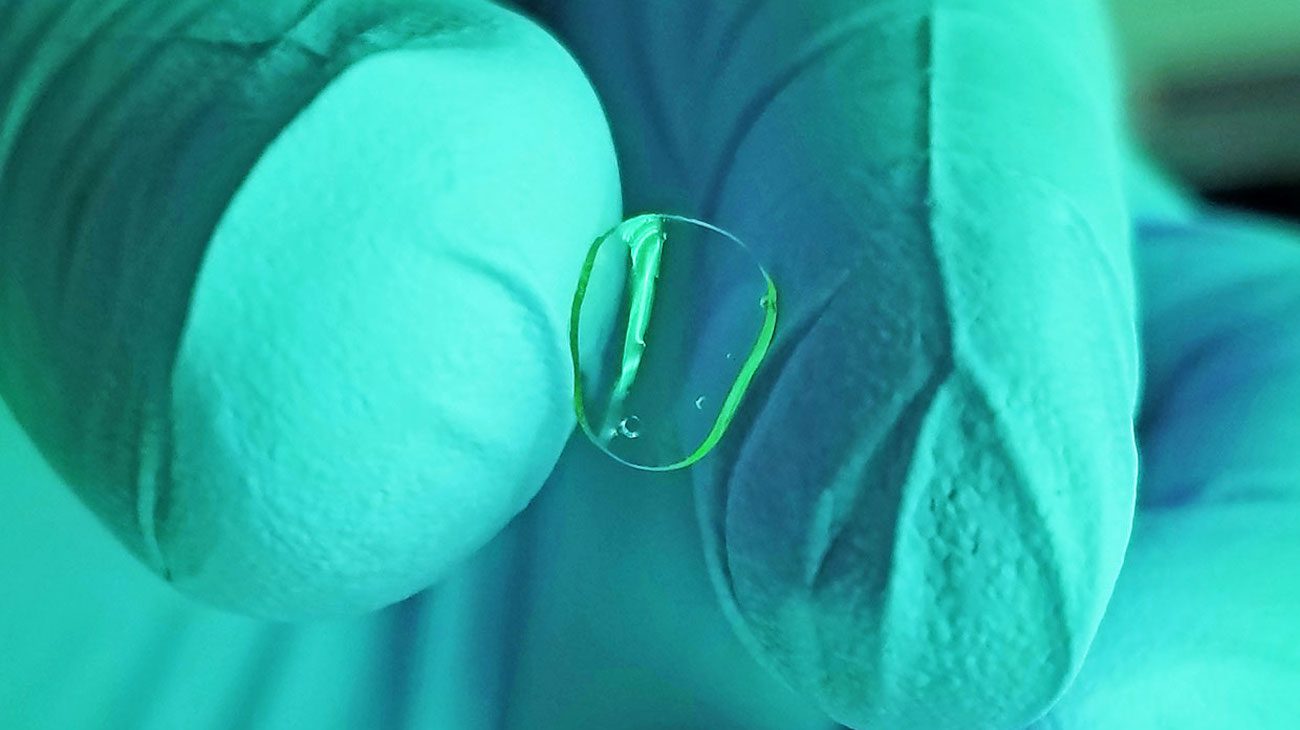 The first artificial cornea, printed on 3D-printer, ready for transplantation