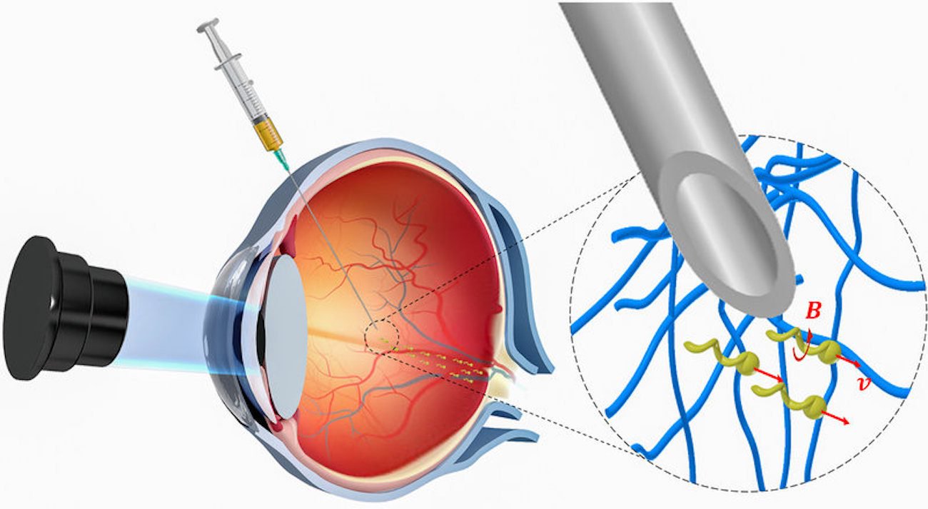 Los nanobots médicos que almacena para el tratamiento de las enfermedades por primera vez en el ojo humano