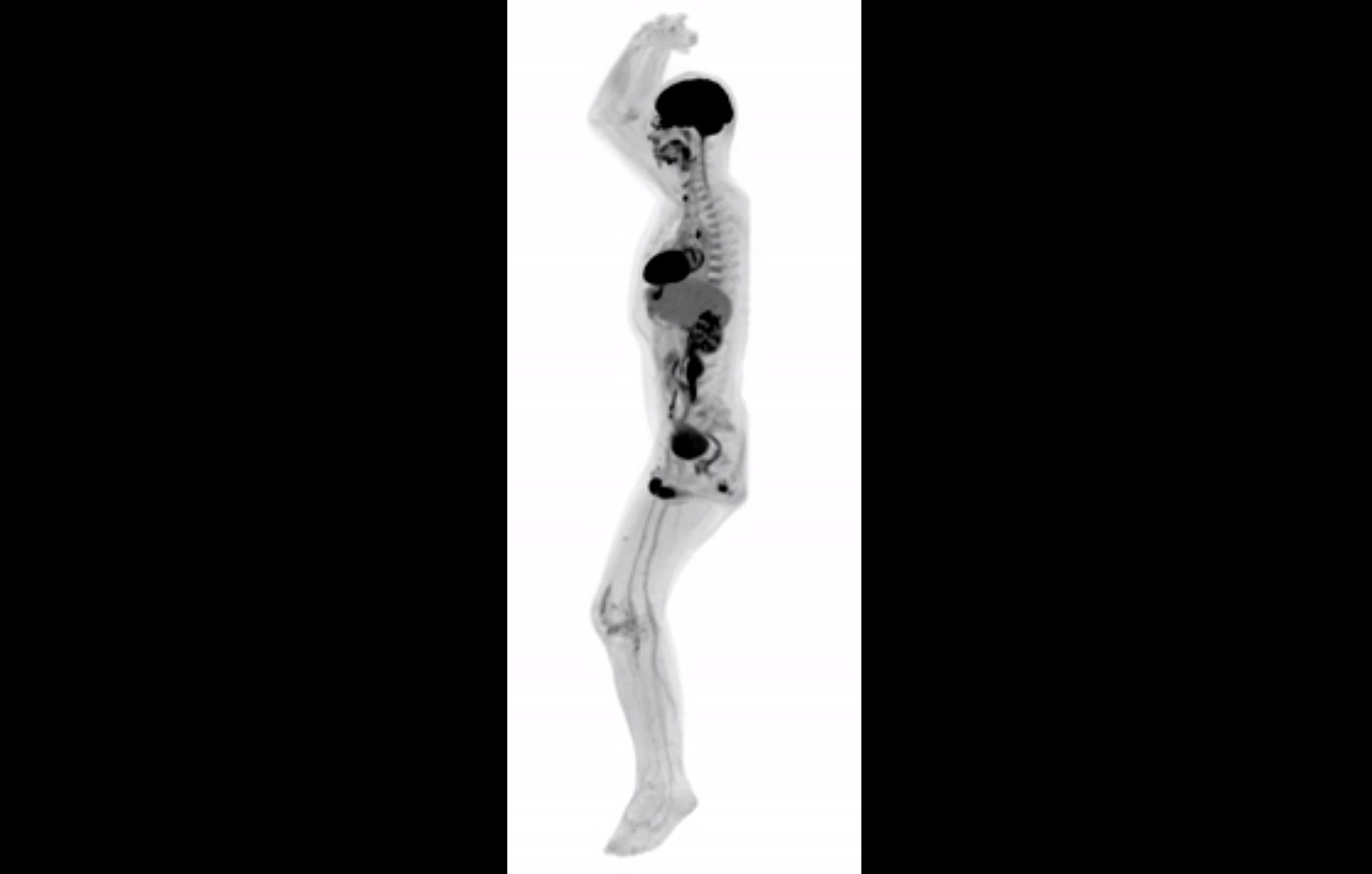 Um novo marco na medicina: Criado o primeiro no mundo, o scanner de corpo inteiro