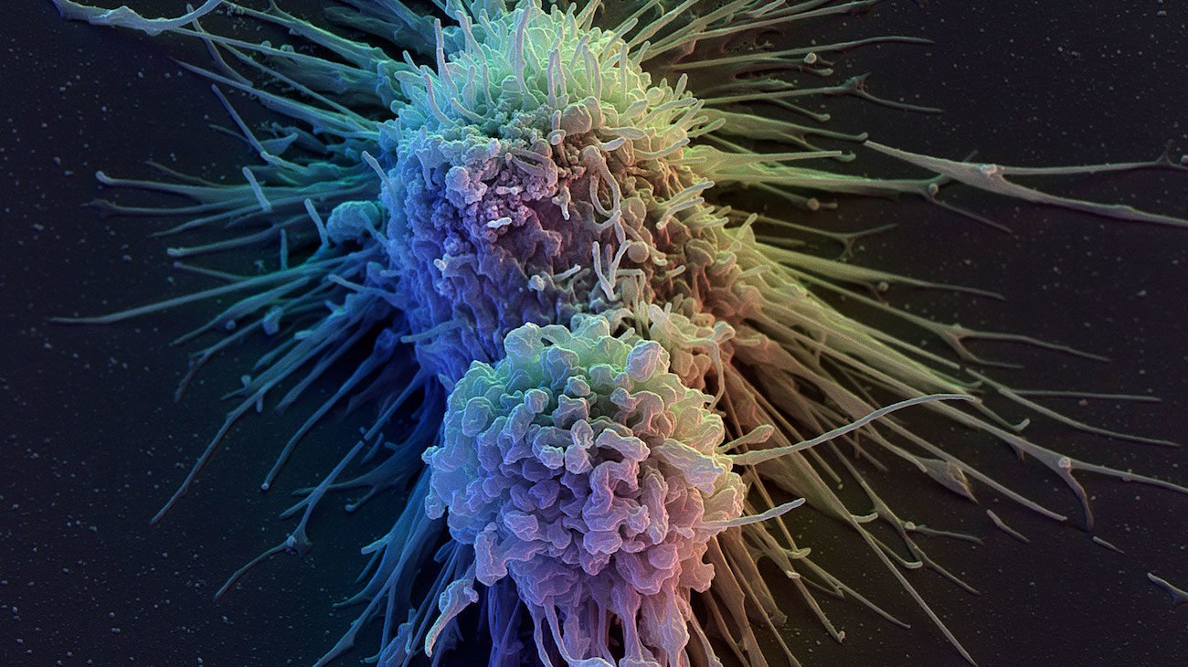 에서 피부세포의 세포의 면역 체계입니다. 도움이 될 것입니다에서 암의 치료