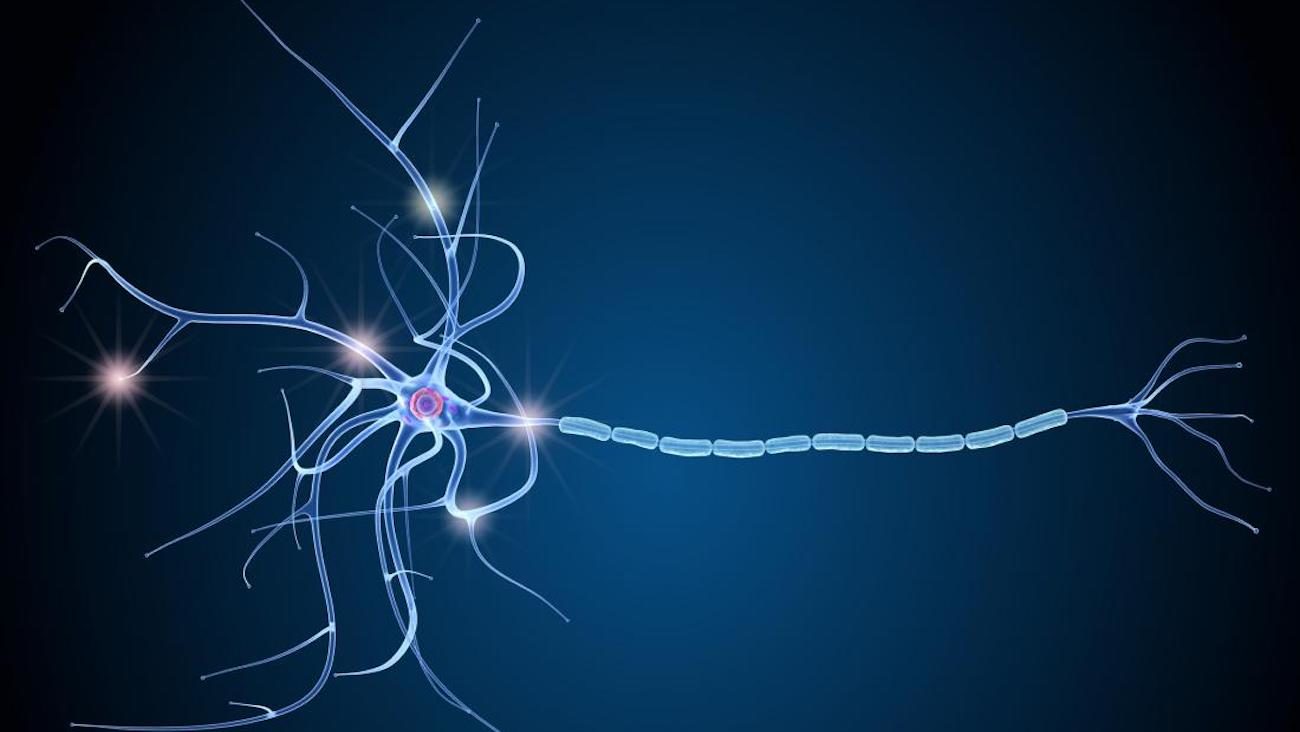 러시아 과학자가 개발한 새로운 더 많은 정확한 방법 MRI 를 뇌의