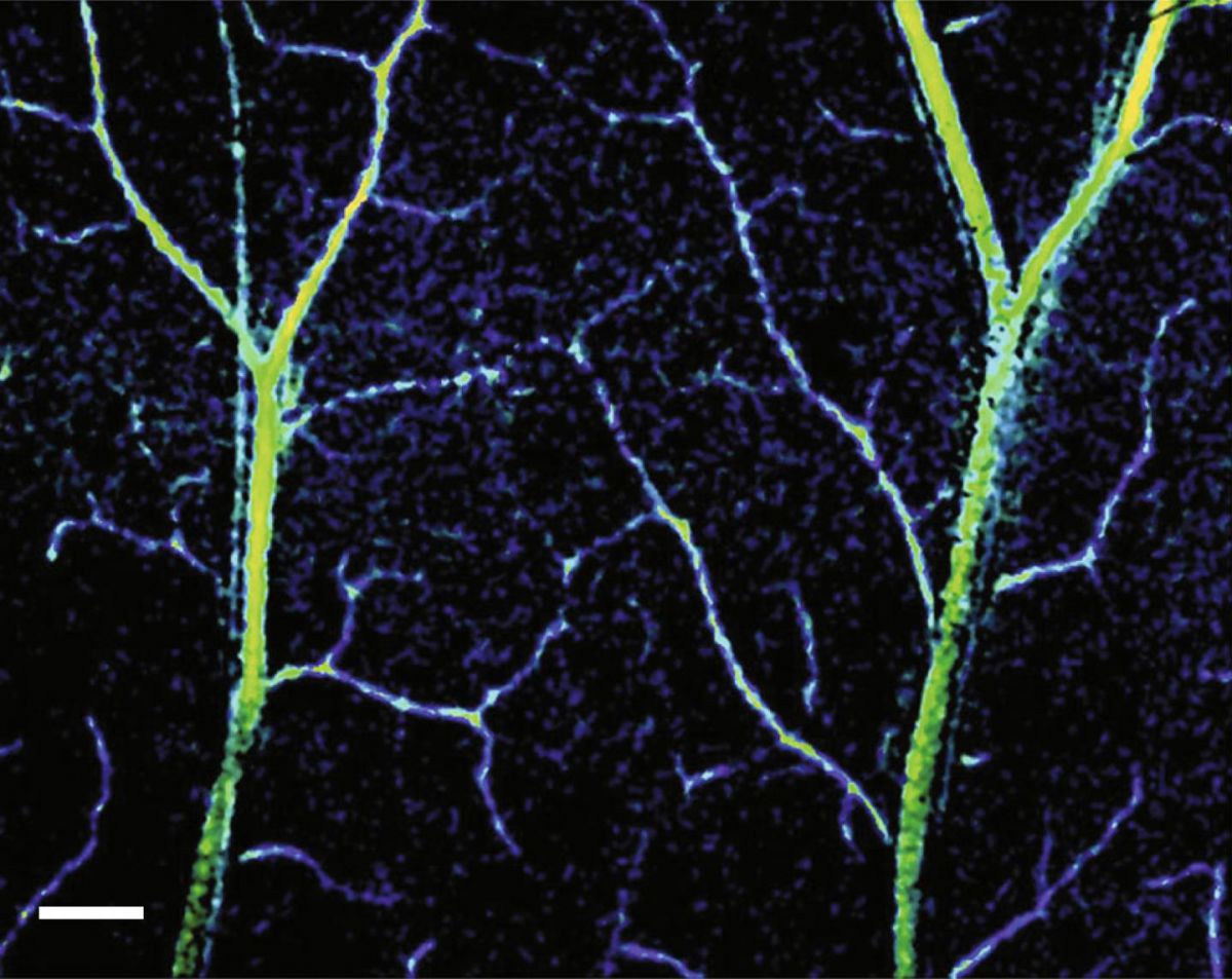 Developed a new method that allows to study in detail the capillaries inside
