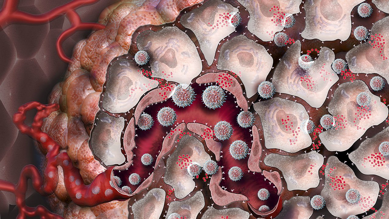 Comme les nanomatériaux, vous aideront dans la lutte contre les tumeurs?