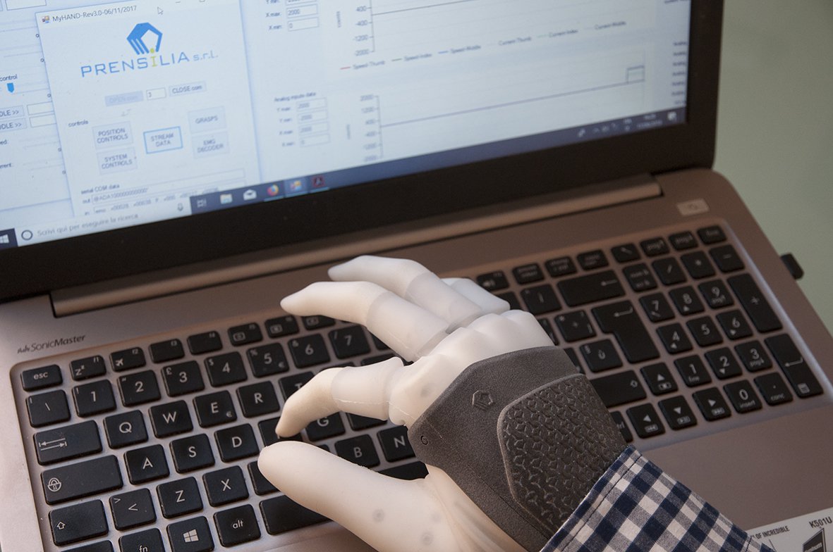 Neue intelligente Handprothese mit erhöhter Empfindlichkeit und Flexibilität