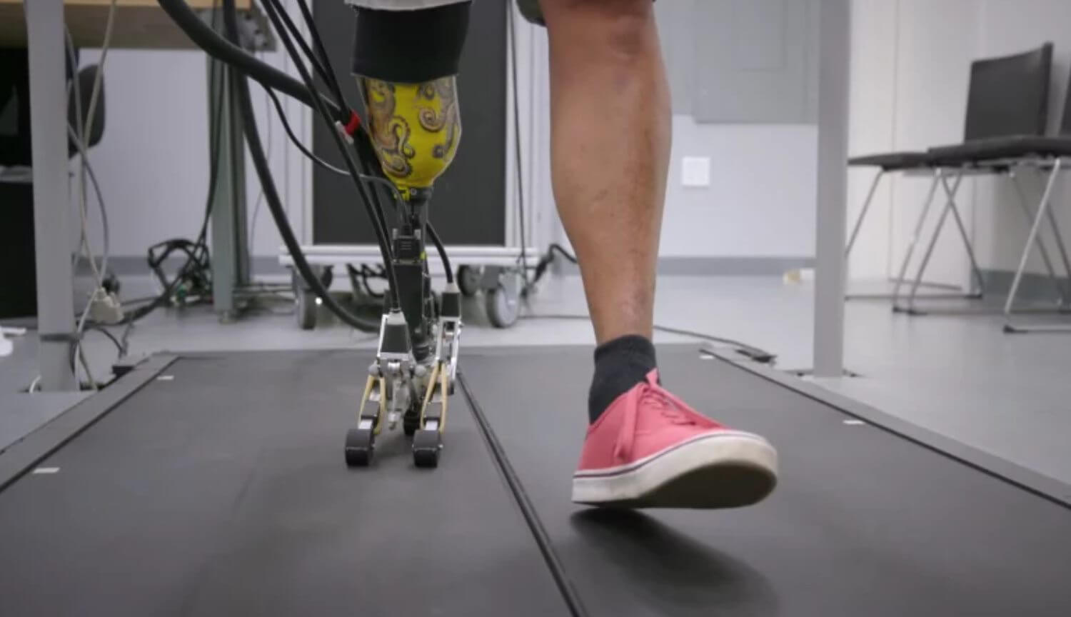 Designed prosthetic leg with realistic foot