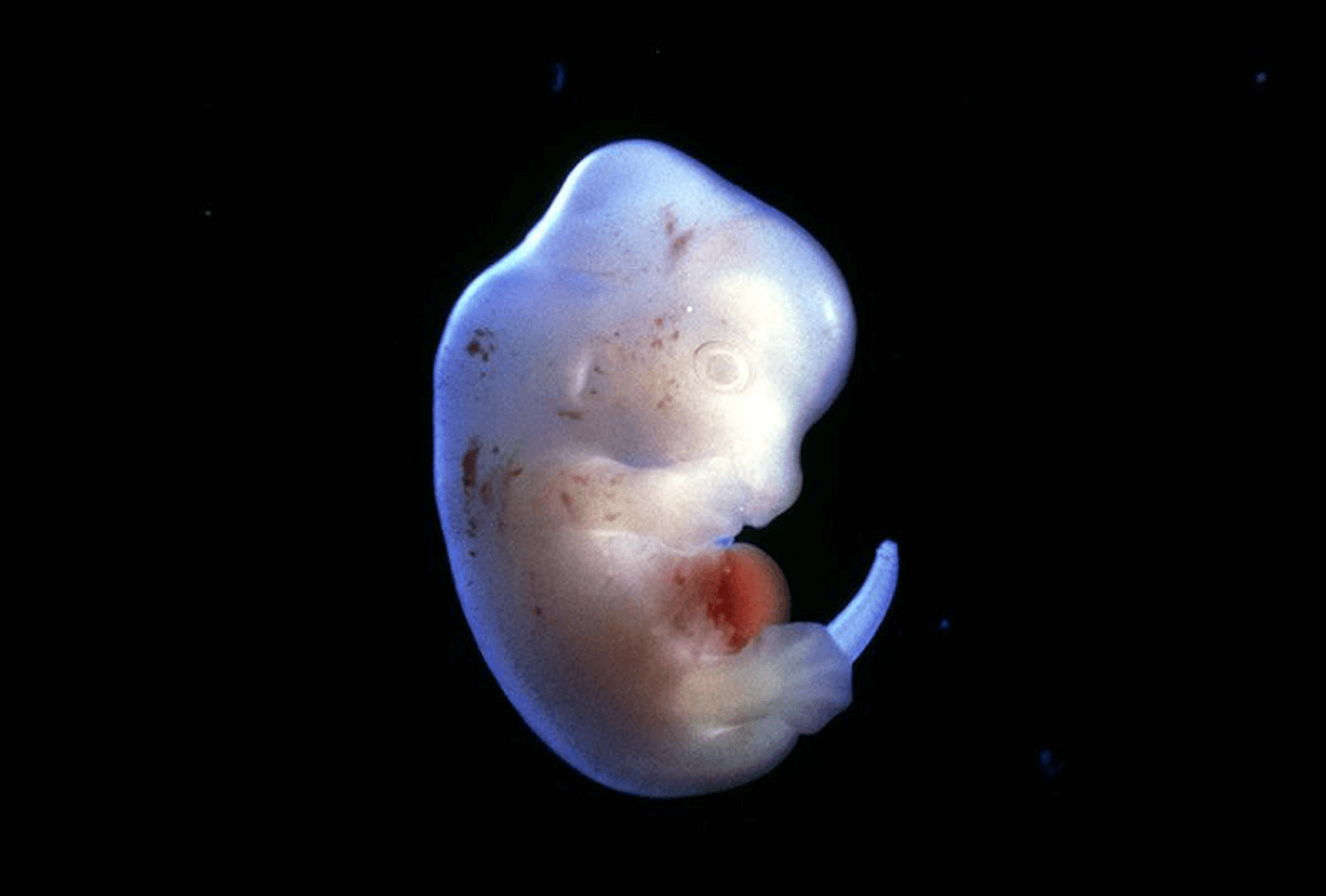 Die Japaner erhielten die Erlaubnis kreuzen Embryo Mensch und Tier