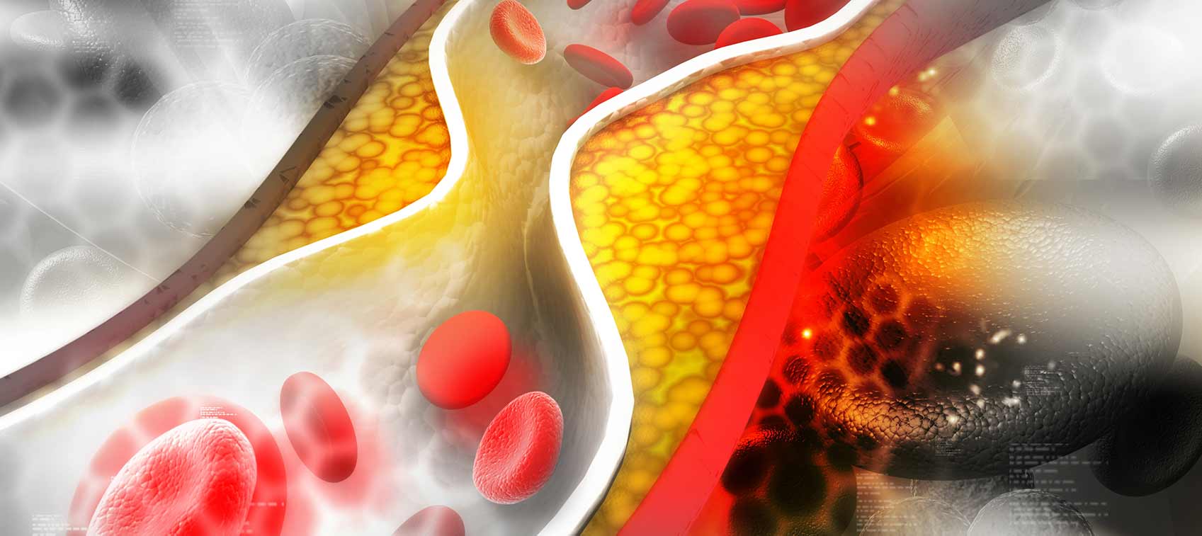 What is cholesterol and dangerous for health?