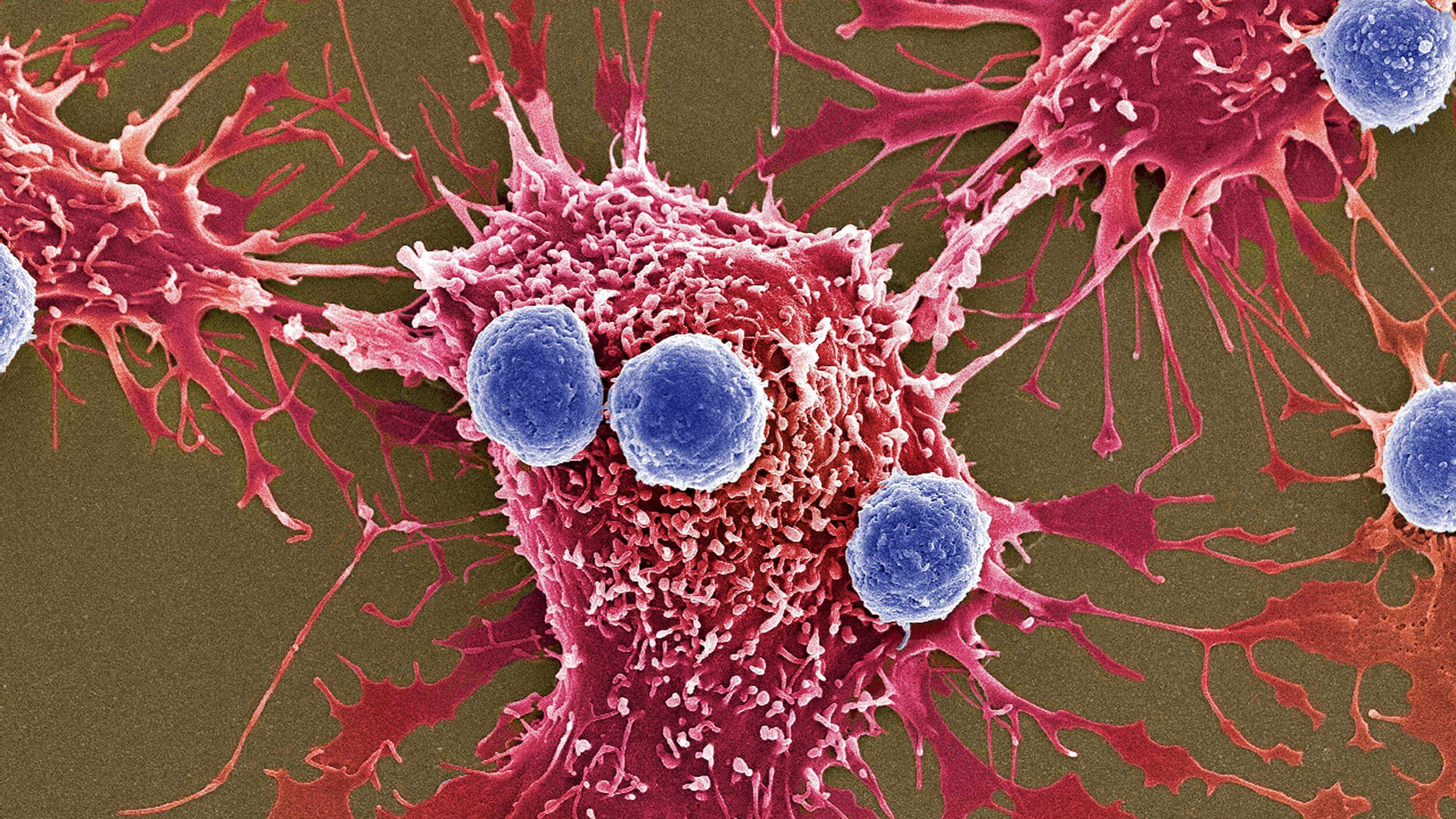 För att förbättra överlevnaden i cancer celler kan äta själva som
