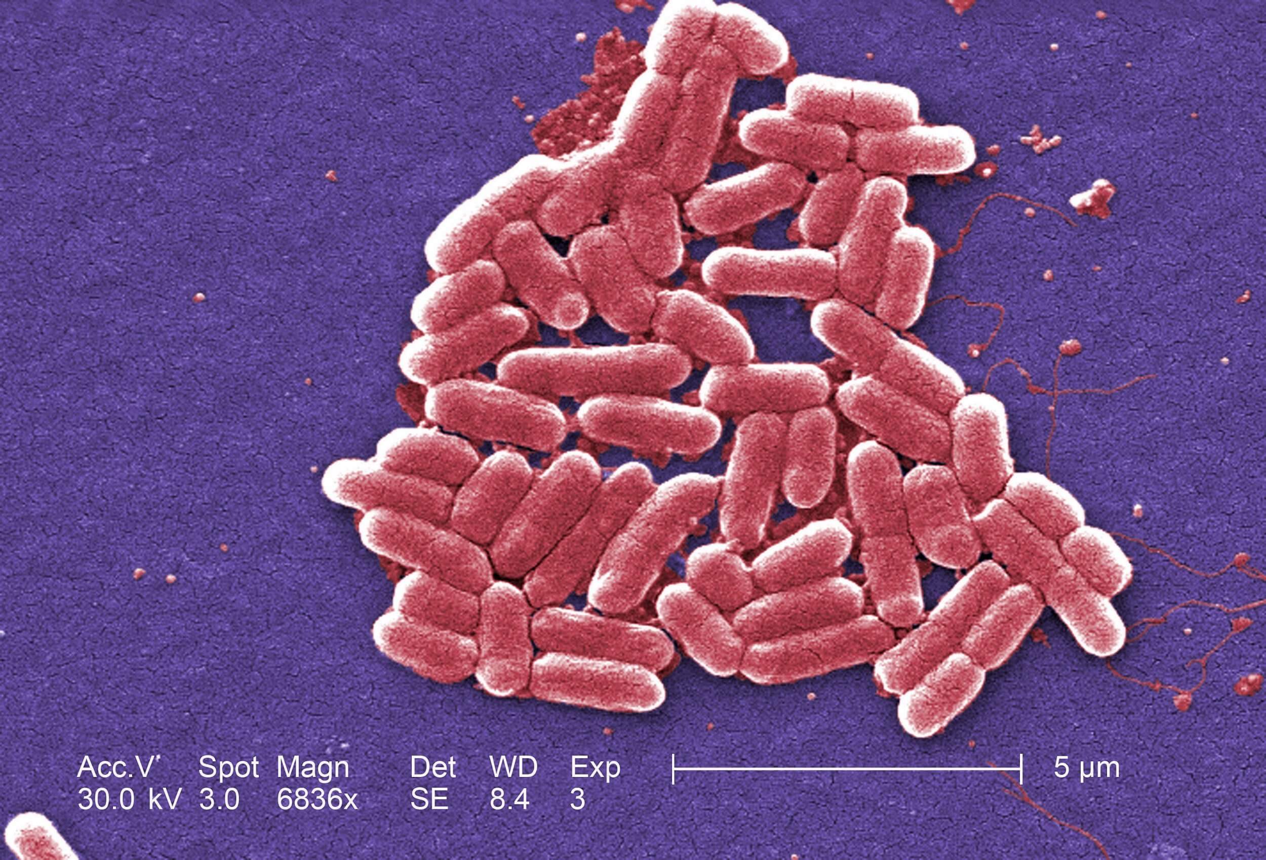 Menschen, die Ihre Hände nicht waschen nach dem Toilettengang, verbreiten Antibiotika resistente Bakterien