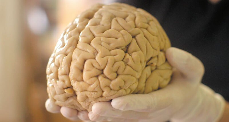 Beyin dokusunun mümkün çalışması için vücut dışında neredeyse bir ay