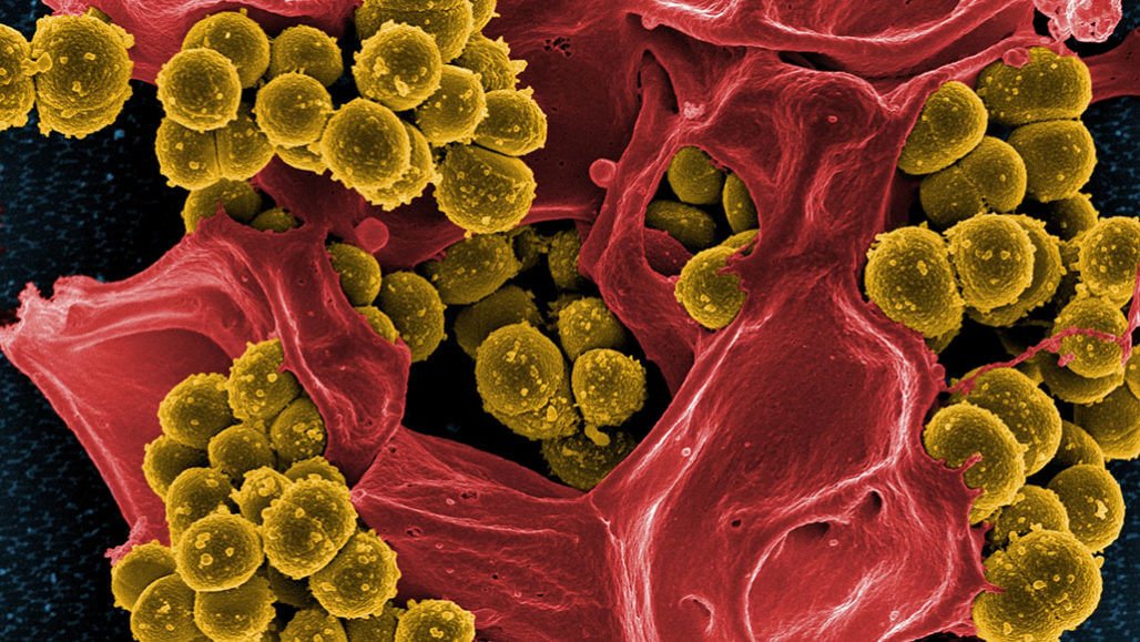 Mikrober, treg et antibiotikum utvikler resistens mot andre