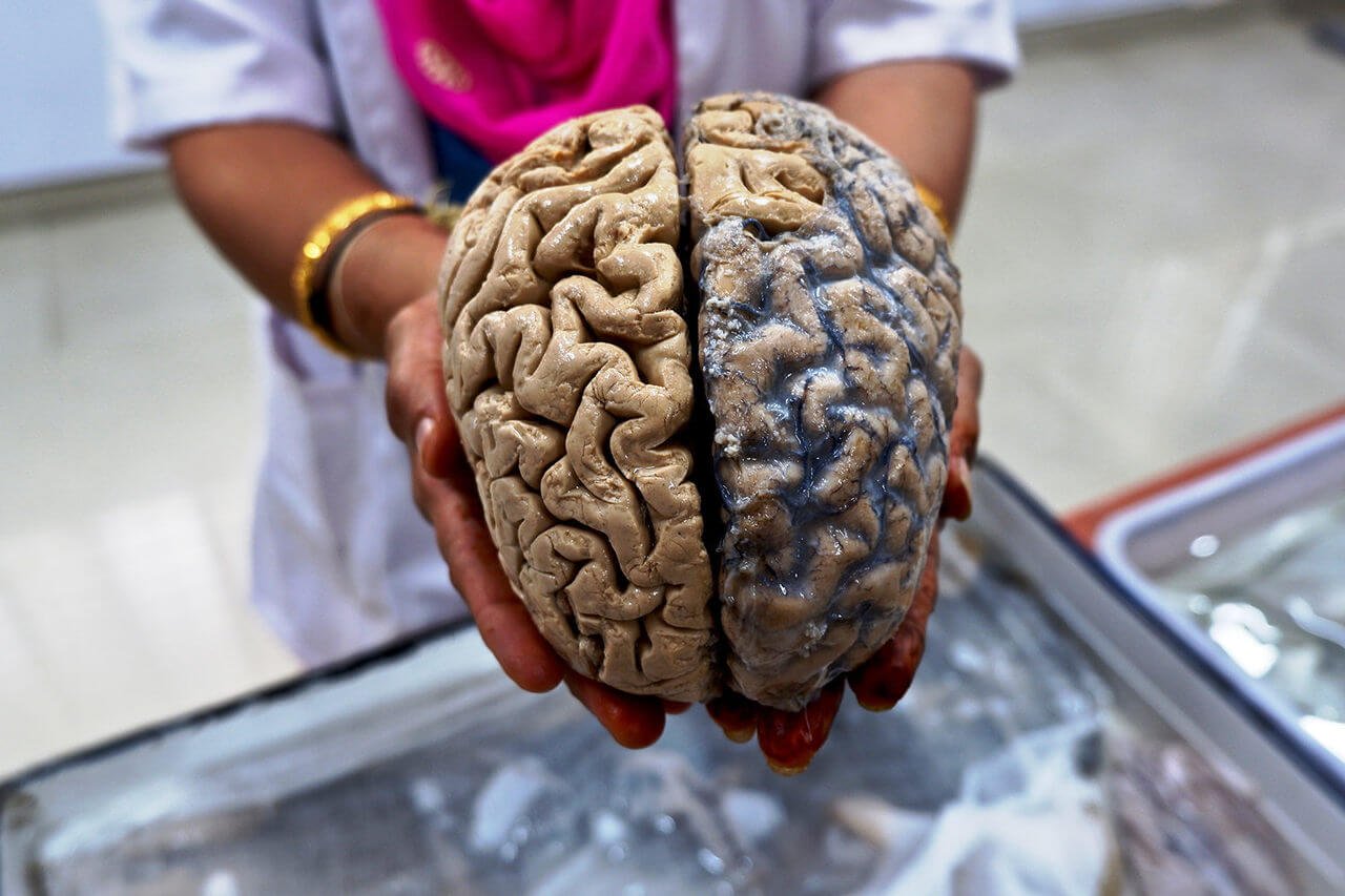 할 수 있는 인간의 뇌하지 않는 붕괴에 대한 수천 년 동안?
