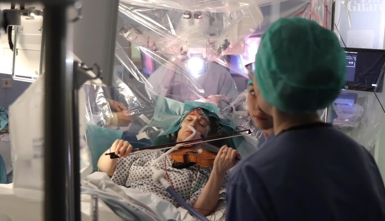 Why surgeons asked the woman to play the violin during brain surgery?