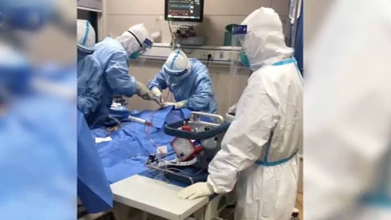 ما هو ecmo وكيف يختلف عن تنفيس ؟ 