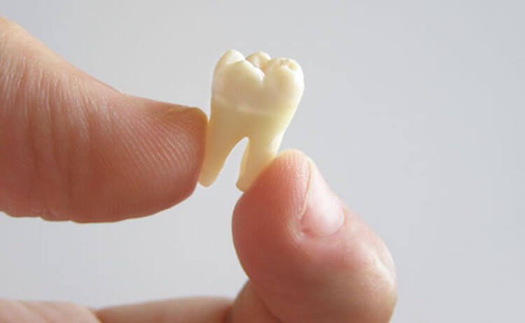 Perché abbiamo bisogno di denti da latte e come crescono