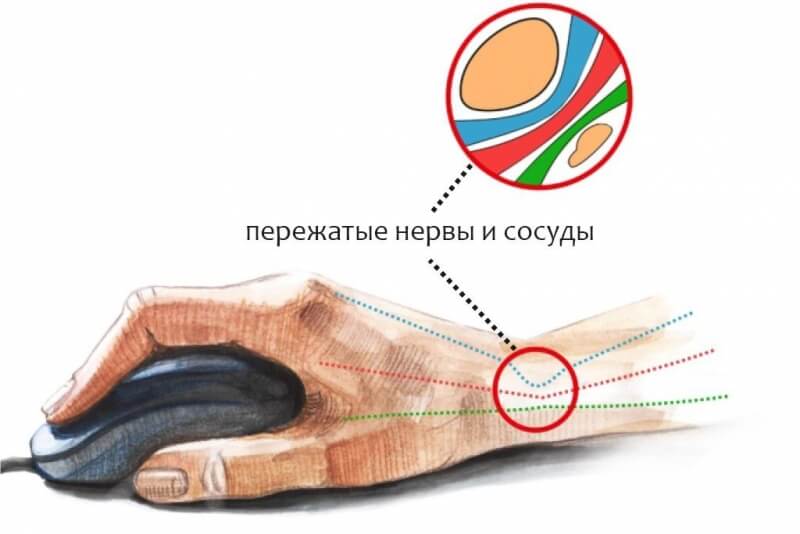 Неге зиянды ұзақ отыруға компьютерде, және оны қалай түзетуге